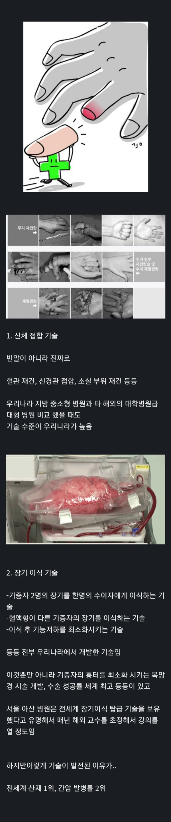 한국이 세계 1위인 의료기술